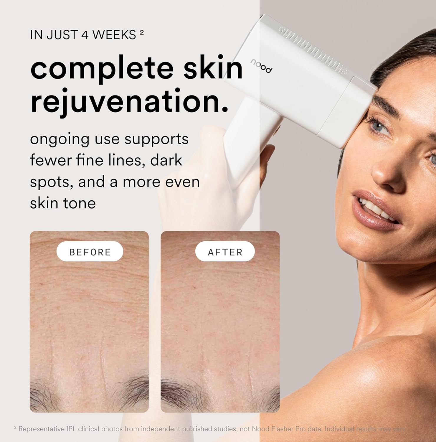 Nood™ Flasher Pro — Forbes Best Product 2026 — IPL Laser Hair Removal Device For At Home Use — Pain-Free, Permanent, Visible Results After First Use & Works Everywhere Hair Grows — Gloss White - Image 4