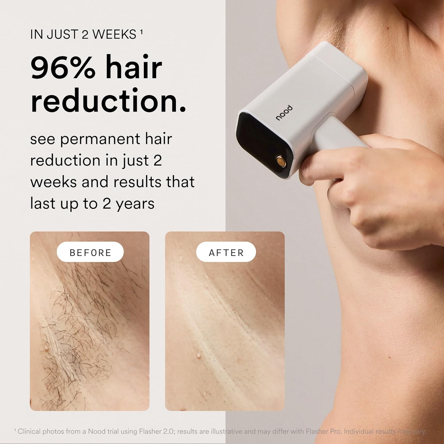 Nood™ Flasher Pro — Forbes Best Product 2026 — IPL Laser Hair Removal Device For At Home Use — Pain-Free, Permanent, Visible Results After First Use & Works Everywhere Hair Grows — Gloss White - Image 3