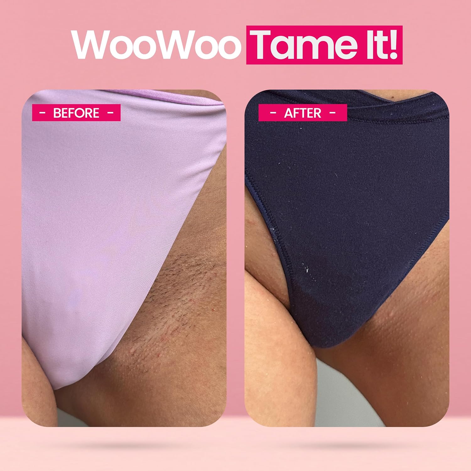 WooWoo Tame It! Natural Intimate Hair Removal Cream - Painless Vegan Hair Remover For Sensitive Skin - Depilatory For Genitals, Bikini, Legs & Bum - Women In-Shower Cream With Aloe Vera - 100ml - Image 5