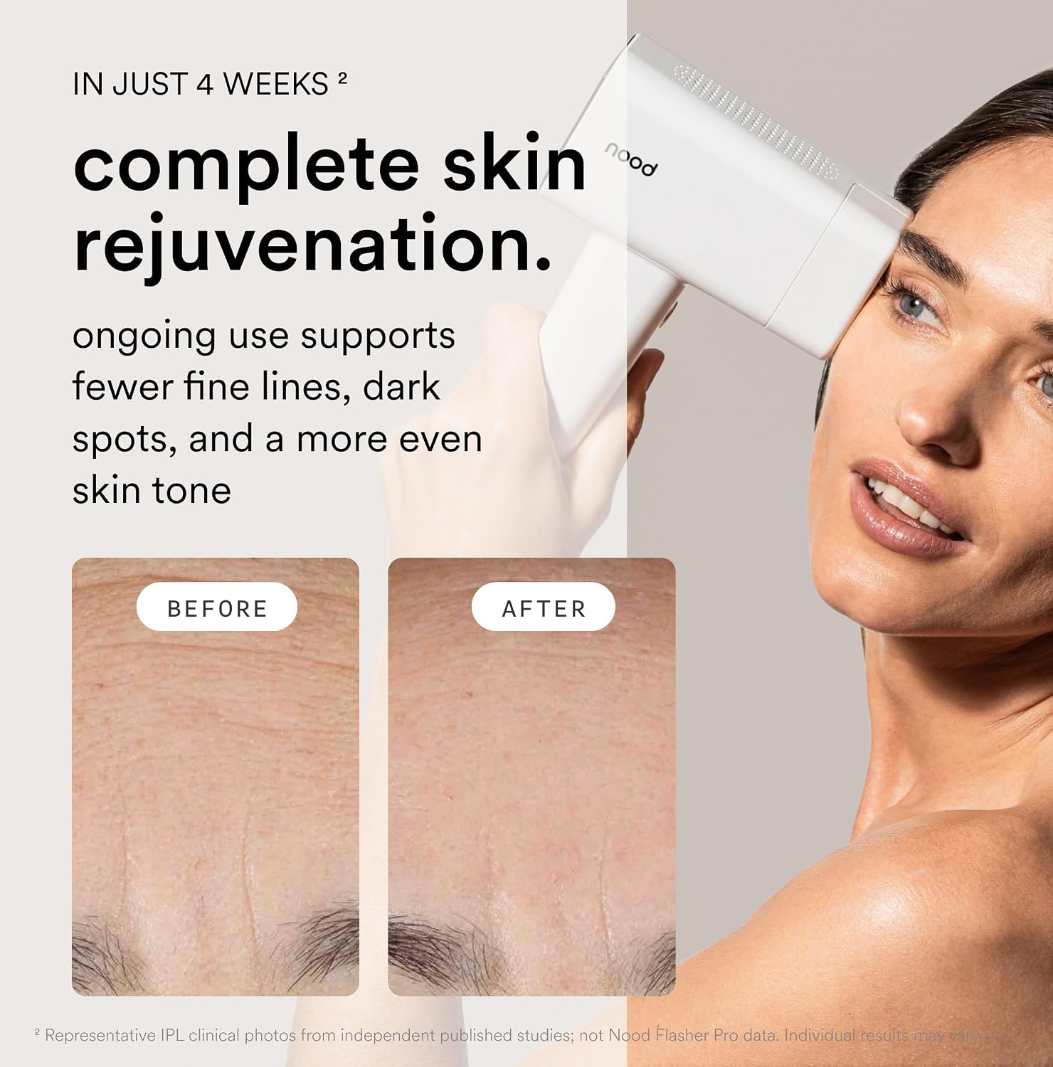 Nood™ Flasher Pro Kit | IPL Laser Hair Removal Device with Pre/Post Care - Image 4