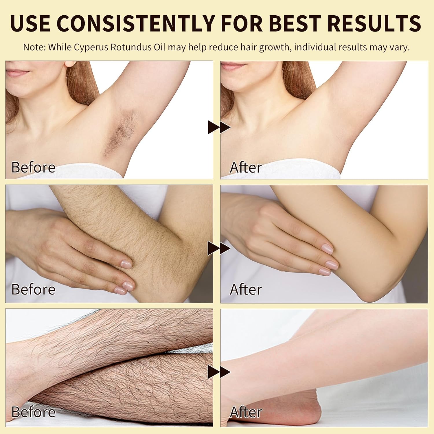 Cyperus Rotundus Oil, 100% Pure Facial Hair Removal Oil, Hair Remover for Face and Body, After Shave Oil for Women, Shrink Pores, Hydrates, Soothes and Repairs Skin - Image 3
